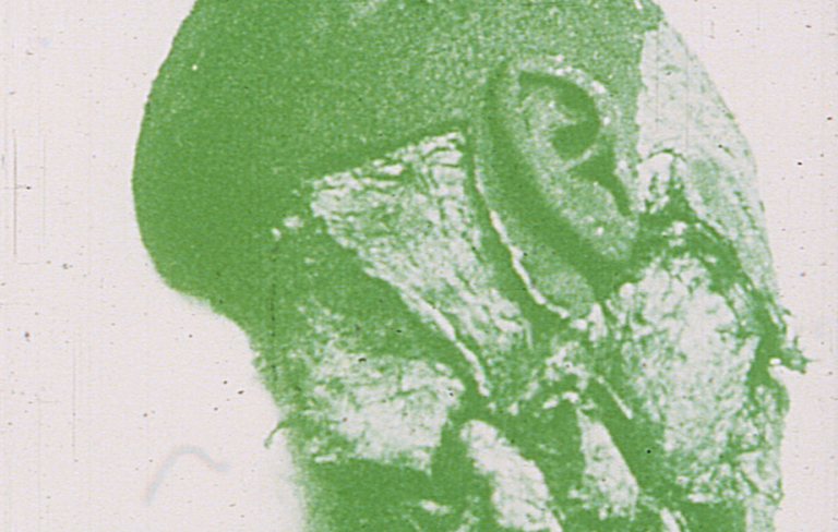 The Green Gate (Magellan at the Gates of Death Part II)